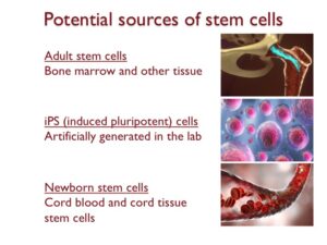 Stem cell therapy explained