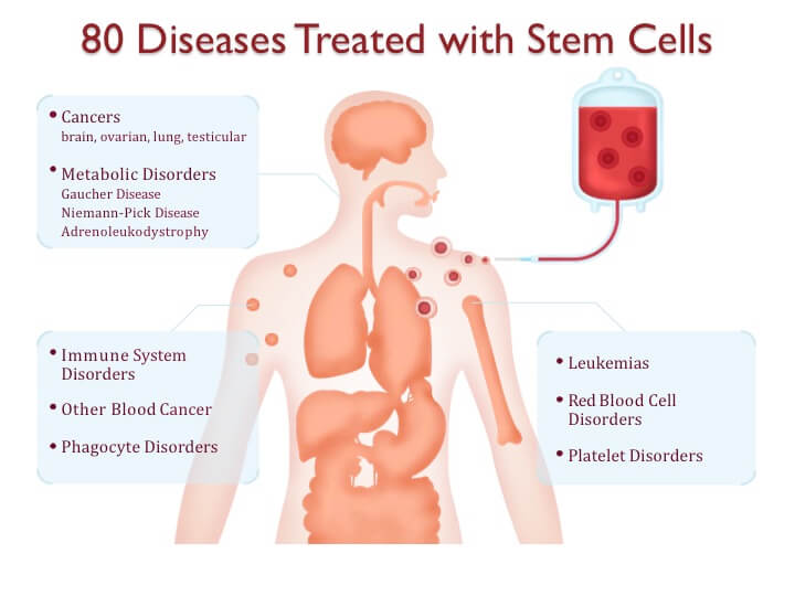 Diagram of the categories of diseases currently treated with stem cells.